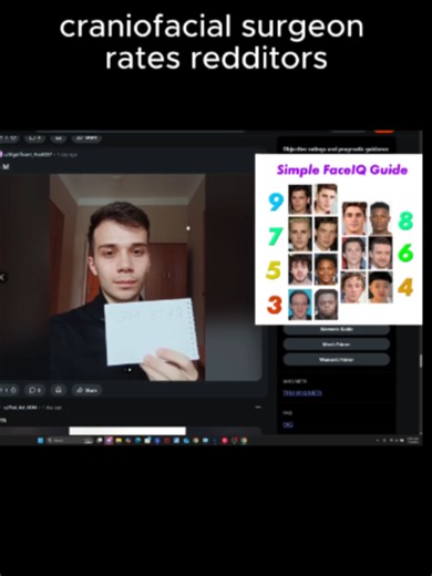 Get your face rating and analysis in my bio with FaceIQ Labs. #facerating #facialaesthetics #attractive #looks #faceanalysis