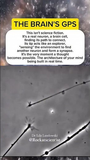 The exact moment a thought is born. #brain #neuron #science #realfacts #humanbody