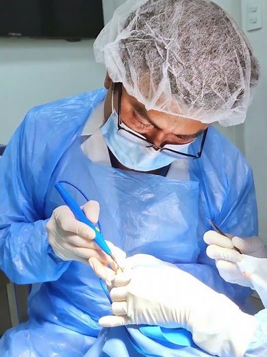 La matricectomía es un procedimiento ambulatorio que se utiliza para tratar uña encarnada
