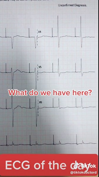 Let’s all get this right 👊. #ecg #doctor #cardiology #cardiacrhythm