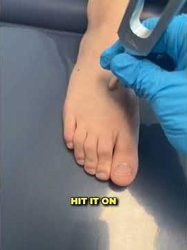 Is Your Foot Hiding A Stress Fracture?