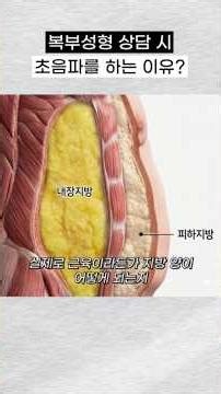 Why get an abdominal ultrasound? The subtle difference that determines a successful abdominis lift