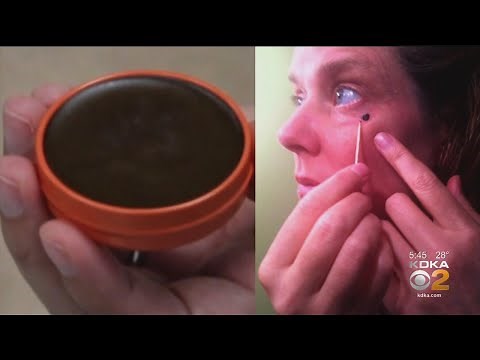Doctors Warn About The Use Of Black Salve As A Cure For Skin Cancer