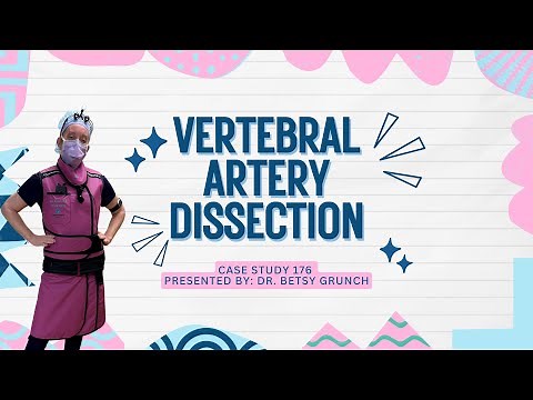 𝐂𝐚𝐬𝐞 𝐬𝐭𝐮𝐝𝐲 176 - Vertebral artery dissection