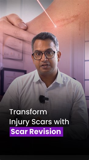Medtrust Aesthetics | Cosmetic Surgery on Instagram: "Scar revision treatment can significantly improve the appearance of injury scars by refining texture, reducing visibility, and restoring smoother skin. Dr. Aashish Sasidharan explains how personalised scar revision techniques help achieve natural-looking, long-term results based on scar type and skin condition. #ScarRevision #ScarTreatment #InjuryScars #SkinRejuvenation #DrAashishSasidharan #MedTrustAesthetics #CosmeticSurgery"
