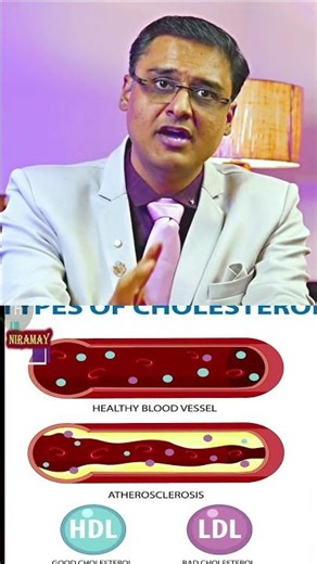 heart blockage , Cholesterol TREATMENT, Triglycerides Diet, Cholesterol Symptoms, High Cholesterol