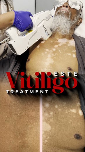 15K views · 87 reactions | ✨ Even Skin, Renewed Confidence – Vitiligo...