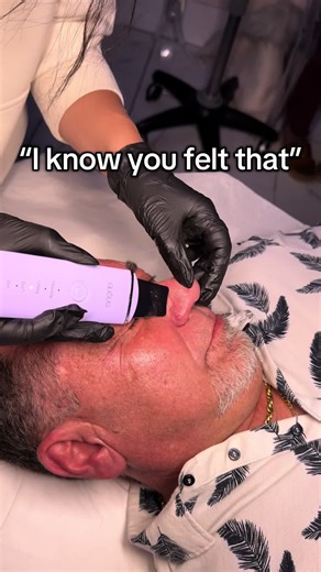 Pimple Extractions Explained: What to Expect