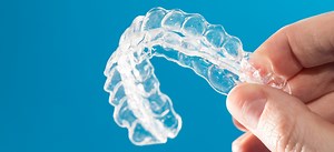 Cost of Invisalign Treatment in Singapore in 2025: Price Plans and Student Packages