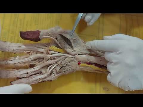 Dissection: Muscles of Hand