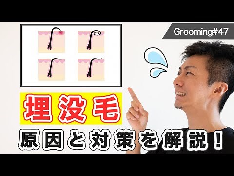 【ヒゲ悩み】埋没毛に悩んでいる方必見！原因と対策を徹底解説！