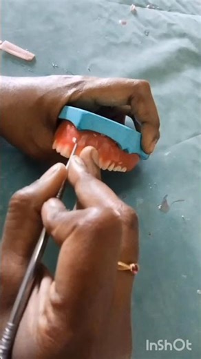 Easy wax carving technique #waxcarving #completedenture#prosthodontics