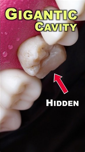 Look What You Can't look ! Teeth #educational