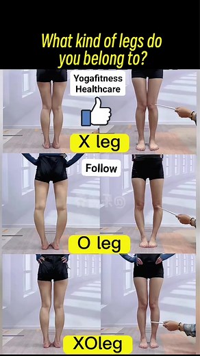3.4K views · 11 reactions | What kind of legs do you belong to ? #legs #legsworkout #legstretch #legshape #Thinlegs #slimlegs #yogafitnesshealthcare #fypシ゚viralシ #viralpost2023 #viralpostviralpost #fypシ゚viral #fypシ゚ #fyp代做 #fullbodyworkoutvideo #foryouシ #workoutmotivation #workout #workoutroutine Yoga Fitness Health Care | Yoga Fitness Health Care | Facebook