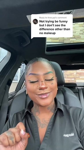 Natural-Looking Cheek and Jawline Fillers: Before and After Transformation