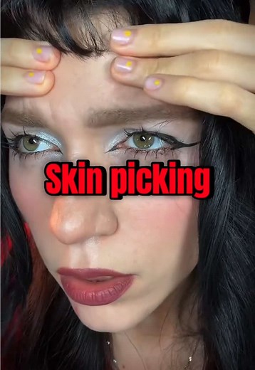 Overcoming Pimple Picking: A Personal Journey