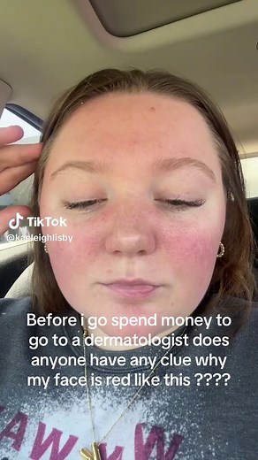 Understanding Red Facial Skin: Causes and Solutions