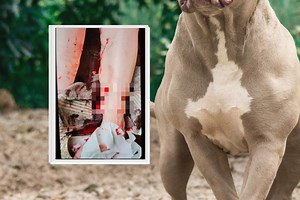 Horrific graphic pictures show aftermath of dog attack