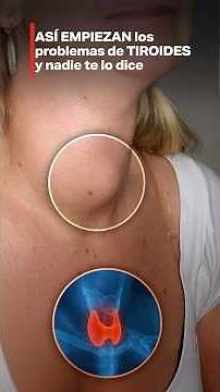This is how thyroid problems start, and nobody tells you.