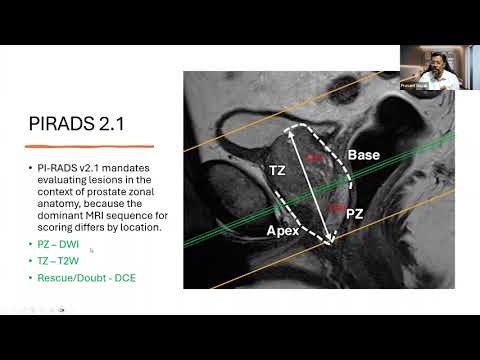 GMT20260113 143345 Recording 1920x1080