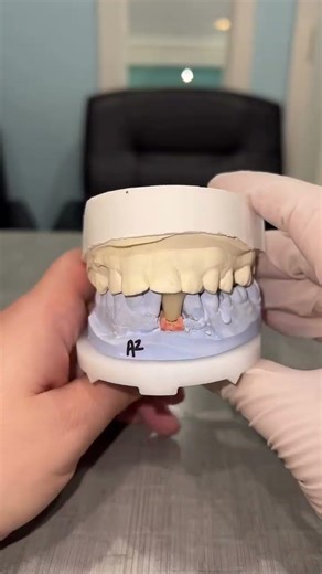 Protect Your Smile with a Single Tooth Implant #chicagodentist