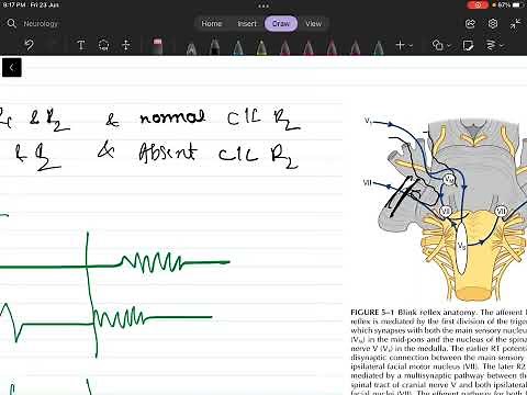 Blink reflex # neurology # facial nerve #trigeminal nerve