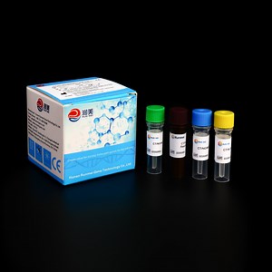 [Hot Item] Realtime PCR Detection Kit CT Ng Mg Nucleic Acid Multiplex Detection Kit