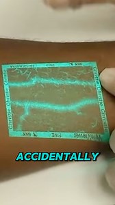 1.2M views · 9.3K reactions | Precision Vein Finder for Accurate...