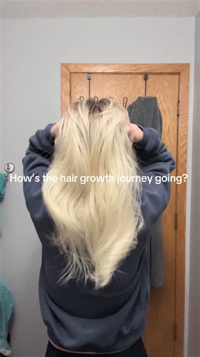 Hair Growth Journey Insights: Tips and Progress