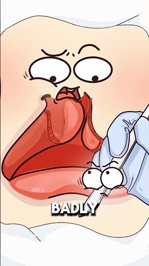 How Cleft Lip Surgery Helps Kids Smile Normally Again 👶✨..!!#e2dhealth #animation #2dshow #health