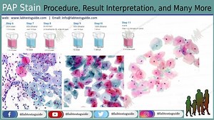 Papanicolaou Stain Introduction, Principle, Staining Procedure, Result Interpretation and Keynotes