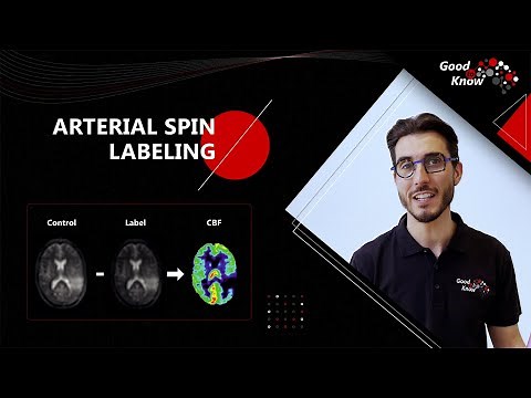 Good To Know - Arterial Spin Labeling (ASL)