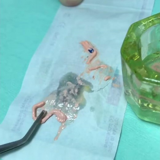 Effect of chloroform on guttapercha by mazen doumani