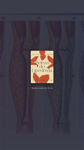 Lipedema has stages. And the right treatment depends on understanding which stage you're in.