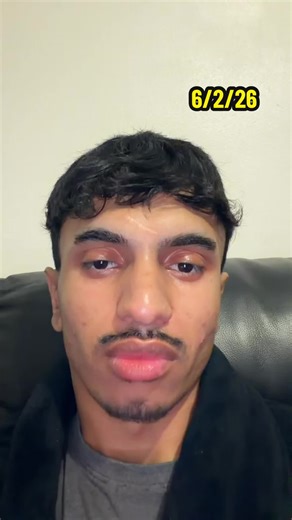 Understanding the Benefits of Dual Treatments for IBD