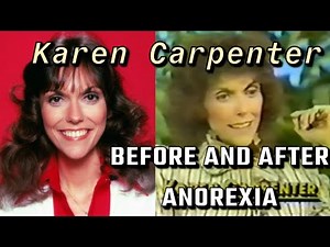 Karen Carpenter: Before & After Anorexia