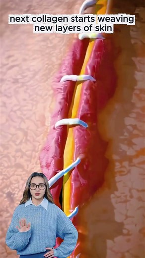 What Really Happens When You Get Stitches?! #StitchesExplained #Viral #BodyScience #MedicalFacts