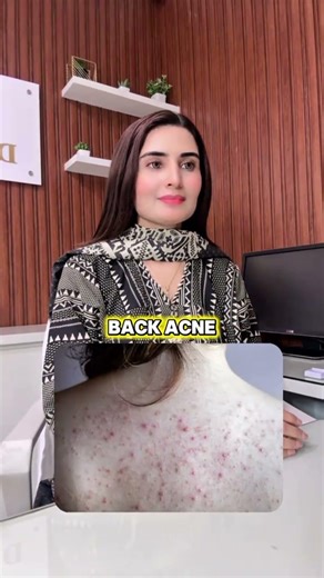 Skin Problems Solved: Easy & Fast Solutions for Everyone #dranamaltaf #shorts #skincareroutine