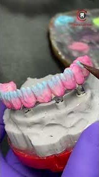 NeoPrep™ Full-Arch Restoration | CAD/CAM Precision & Engineered Performance