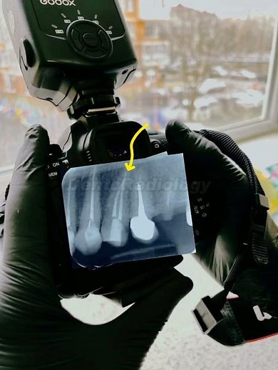 Learn To Read Your OWN Dental X-rays!