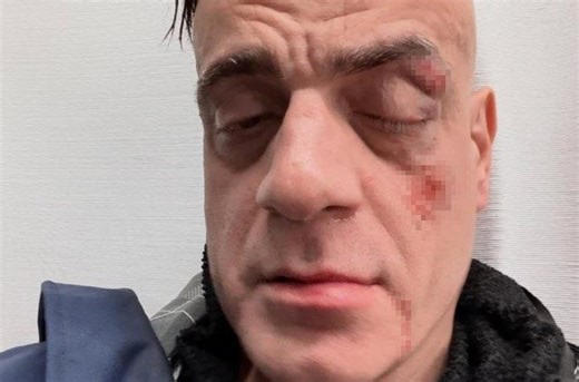 Picchiò lo youtuber Cicalone in metro a Roma, estradato in Italia uno degli aggressori del “clan Hitler”