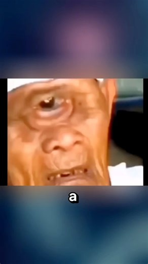 A man with one eye #cyclopia #rare #congenital #mystery #strange | Jessa Mae Ali Valmores