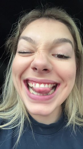 Braces Off Today Vlog - Final Color, Power Chains, and Coming Adjustments