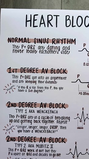 Understanding Heart Blocks Through a Modern Love Story