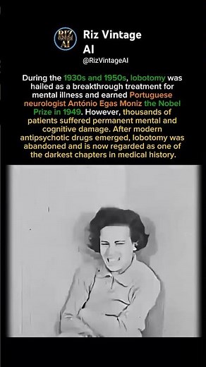 Lobotomy: When a Medical Mistake Won a Nobel Prize