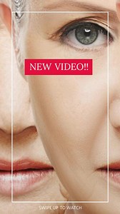 How long does Botox last? Watch 🎥 https://youtu.be/bOuTtyja2No | Rajani MD