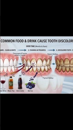 “How to Whiten Your Teeth at Home (What Actually Works)”