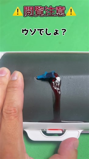 ルート確保コツと逆止弁なしの注意点