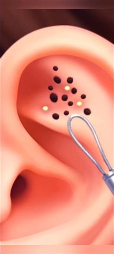 modified ASMR ear cleaning #animation #asmr