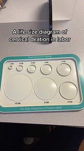 A life size diagram of cervical dilation in labor! #reels - - - #laboranddelivery #nurse #ernurse #icunurse #nursesoftiktok #nursing #nurselife #hospitaltiktoks #hospitallife #foryou #fyp #nursings #healthcare #healthcareworker #birth #baby #givingbirth #labor | Anna the Nurse